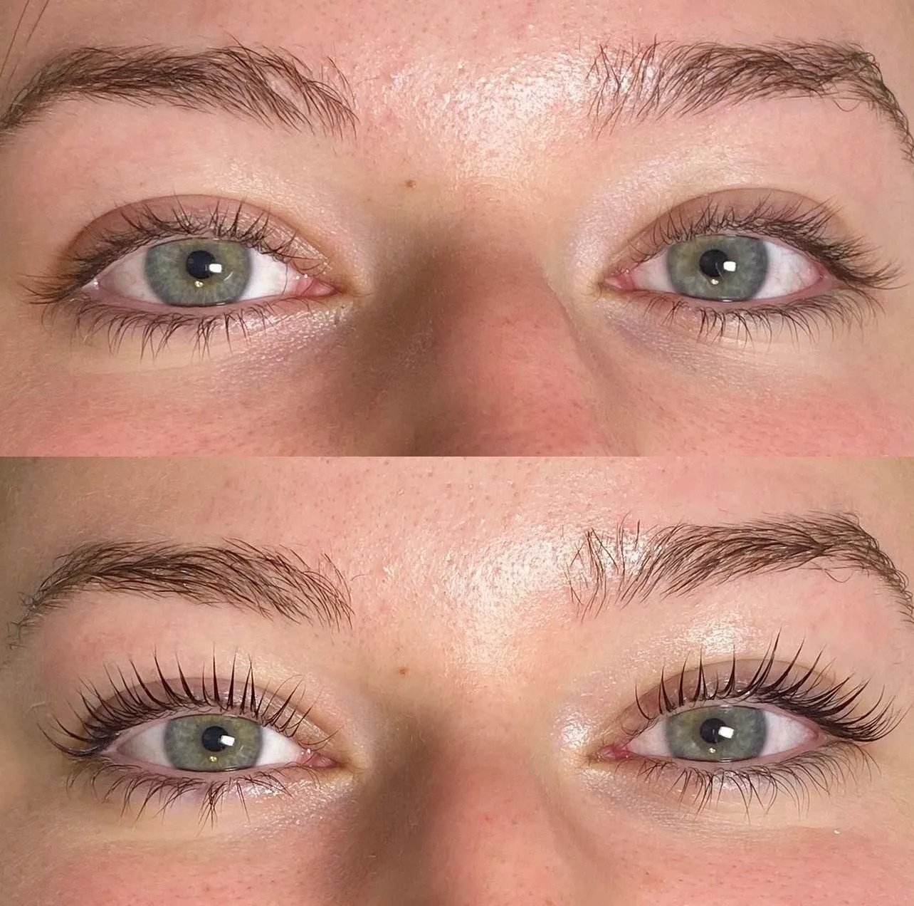 A before and after picture of the same woman 's eyes.