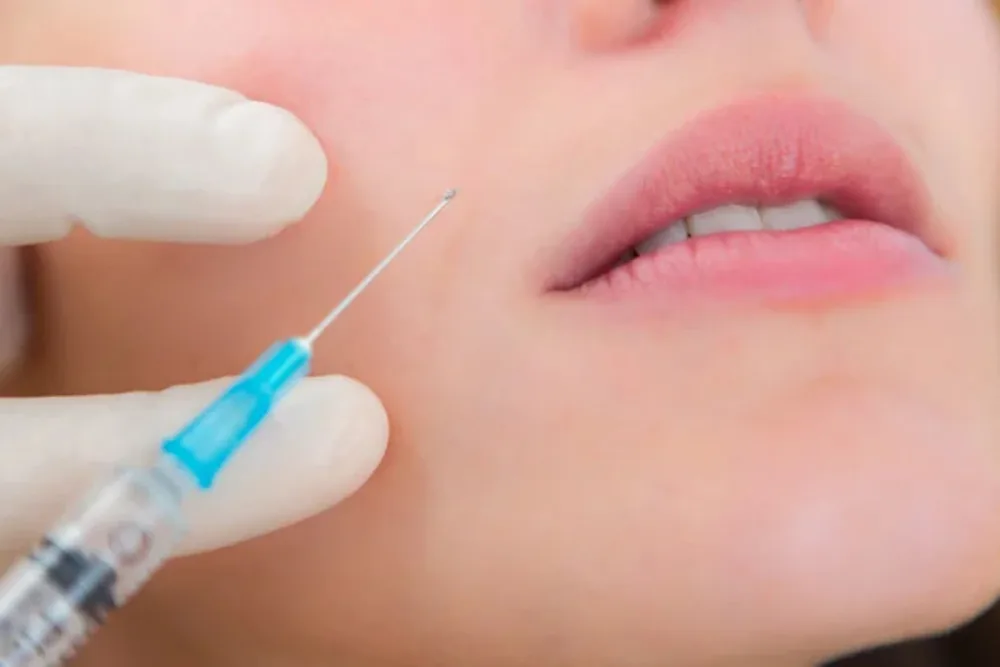 Dermal Fillers Small 1