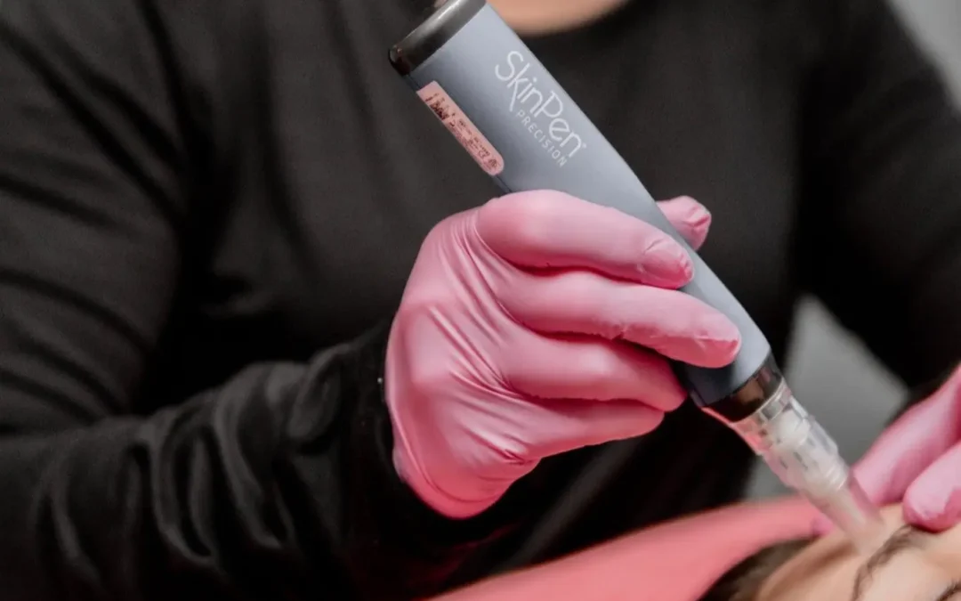 How SkinPen Microneedling Transforms Skin at BloGo Salon + MedSpa in Tuscaloosa