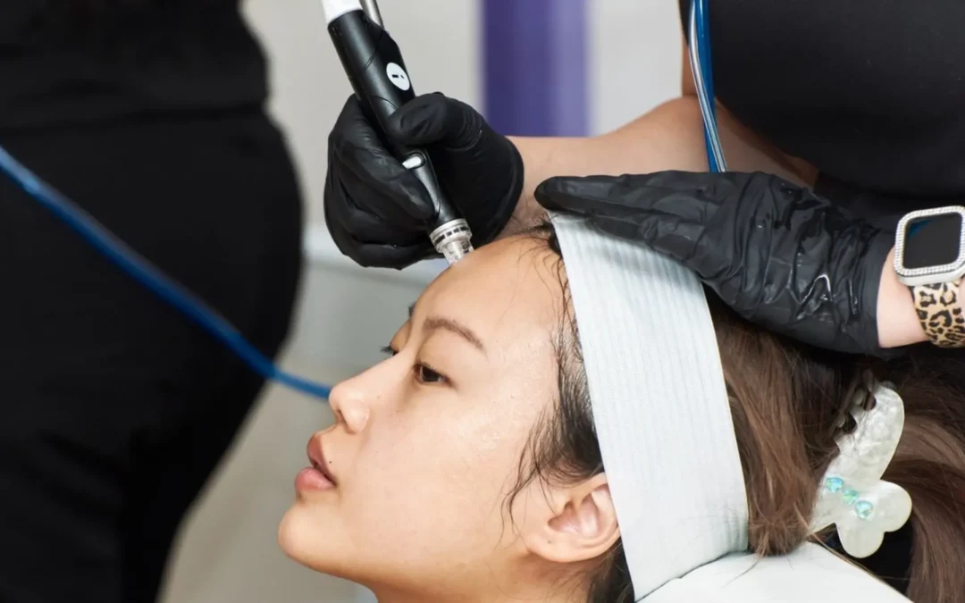 What is a HydraFacial? How does it work?