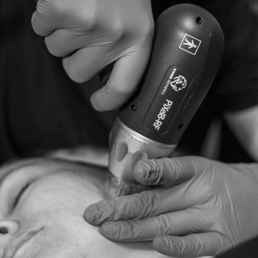 A person is using an electric hair dryer on another person 's face.